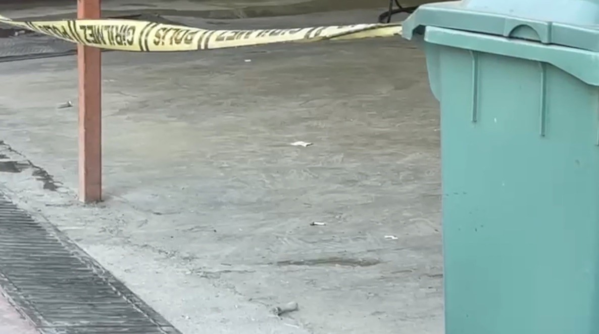 Çorum'da bir şahıs, eski patronunu silahla bacağından vurarak yaraladı (2)