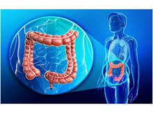 Kalın bağırsak kanseri 3. sırada