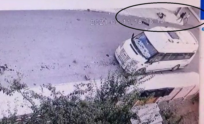 ÇORUM'DA PİTBULL DEHŞETİ PİTBULLUN SALDIRDIĞI ÇOCUK HASTANELİK OLDU